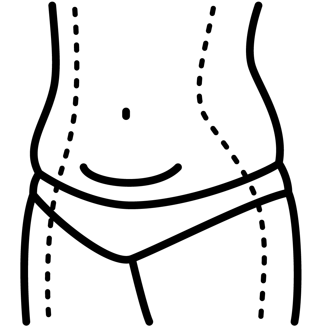 Liposuction, body, fat, cosmetic, surgery, front